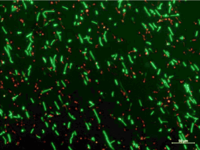 B Burgdorferi mit Minocyclin
